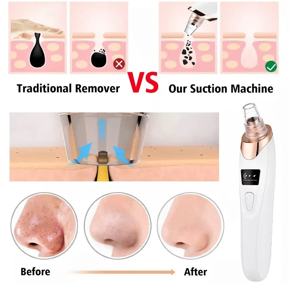5in1 Blackhead Remover Machine Rechargeable